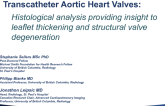TCT-69: Transcatheter Aortic Heart Valves: Histological Analysis Providing Insight to Leaflet Thickening and Structural Valve Degeneration