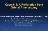 Case #11: A Perforation from Orbital Atherectomy