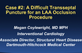 Case #2: A Difficult Transseptal Puncture for an LAA Occlusion Procedure