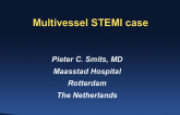 STEMI With Multivessel Disease: How To Proceed?