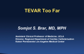 Case #7: TEVAR Too Far