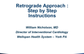 The Retrograde Approach: Step-by-Step Instructions