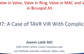 Case #7: A Case of TAVR VIR With Complications