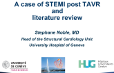 Case Presentation From Switzerland: STEMI Post TAVI