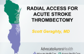 Case #4: Radial Access for Acute Stroke Thrombectomy