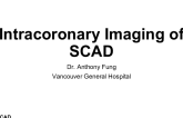 Intracoronary Imaging of SCAD