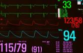 Bradycardia Guidelines Offer Tips on Diagnosis, Management