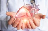 Study Lays Groundwork for Pivotal Trial of Impella CP for LV Unloading Before PCI