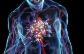 Methotrexate, an Anti-inflammatory, Fails to Lower Risk of Cardiovascular Events: CIRT