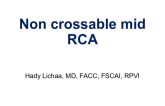 Non crossable mid RCA