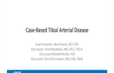 Case-Based Tibial Arterial Disease