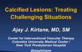 Calcified Lesions: Treating Challenging Situations