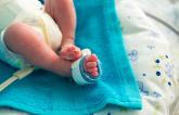 FDA Approves Pea-Sized Occluder for Patent Ductus Arteriosus in Premature Babies