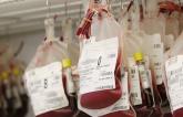 Blood Conservation Strategy Reduces Need for Transfusion Following Cardiac Surgery