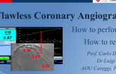 A Flawless Coronary Angiography 