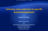 Tailoring valve selection to specific anatomies/patients