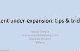 Stent under-expansion: tips & tricks
