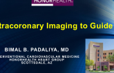 Intracoronary Imaging to Guide PCI