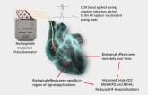 FDA Approves the Optimizer Smart Implantable Pulse Generator for Heart Failure