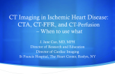 CT Imaging in Ischemic Heart Disease: CTA, CT-FFR, and CT-Perfusion – When to use what