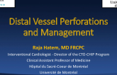 Distal Vessel Perforation and Management