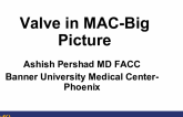 Valve in MAC-Big Picture
