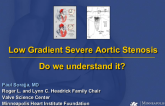 Low Gradient Severe Aortic Stenosis - Do we understand it?