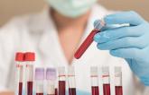 CHARIOT: 1 in 20 Hospitalized Patients Undergoing Blood Tests Have Elevated Troponin 