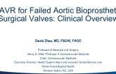 TAVR for Failed Aortic Bioprosthetic Surgical Valves: Clinical Overview
