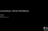 Case Presentation: Atrial Fibrillation