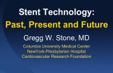 Stent Technology:Past, Present and Future