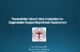 Transcatheter Valve in Valve implantation for Degenerated Surgical Bioprothesis Replacement
