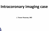 Intracoronary imaging case