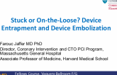 Stuck or On-the-Loose? Device Entrapment and Device Embolization