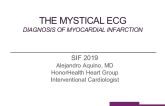 The Mystical ECg Diagnosis of myocardial infarction
