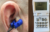 Vagus Nerve Stimulation Lightens Arrhythmia Burden in Patients With Paroxysmal A-fib