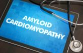 Tafamidis Approved for Treatment of Transthyretin Amyloid Cardiomyopathy