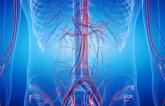 OVER Trial: Long-term Mortality Similar After Endovascular and Open AAA Repair