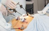 Bariatric Surgery Linked to Survival Advantage After MI and CVA