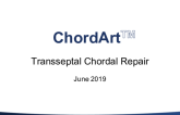 Chordart