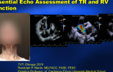 The ‘Essential’ Echocardiography Examination of TR and RV Function