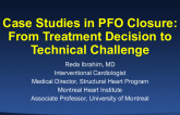 Case Studies in PFO Closure: From Treatment Decisions to Technical Challenges