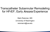 Transcatheter Subannular Remodeling for HFrEF: Early ANCORA Experiences