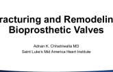 Cracking, Fracturing, and Fracking Bioprosthetic Valves