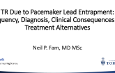 TR Due to Pacemaker Lead Entrapment: Frequency, Diagnosis, Clinical Consequences, and Treatment Alternatives