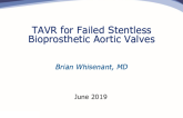Treating a Stentless Bioprosthetic Surgical Valve