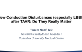 New Conduction Abnormalities (Especially LBBB) After TAVR. Do They Matter?