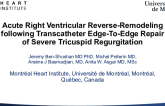 Acute Right Ventricular Reverse Remodeling Following Transcatheter Edge-To-Edge Repair of Severe Tricuspid Regurgitation