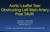 Aortic Leaflet Tear Obstructing Left Main Artery Post-TAVR