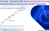 Can Artificial Intelligence/Deep Learning Algorithms Transform Echo Acquisition and Interpretation in Valvular Heart Disease?